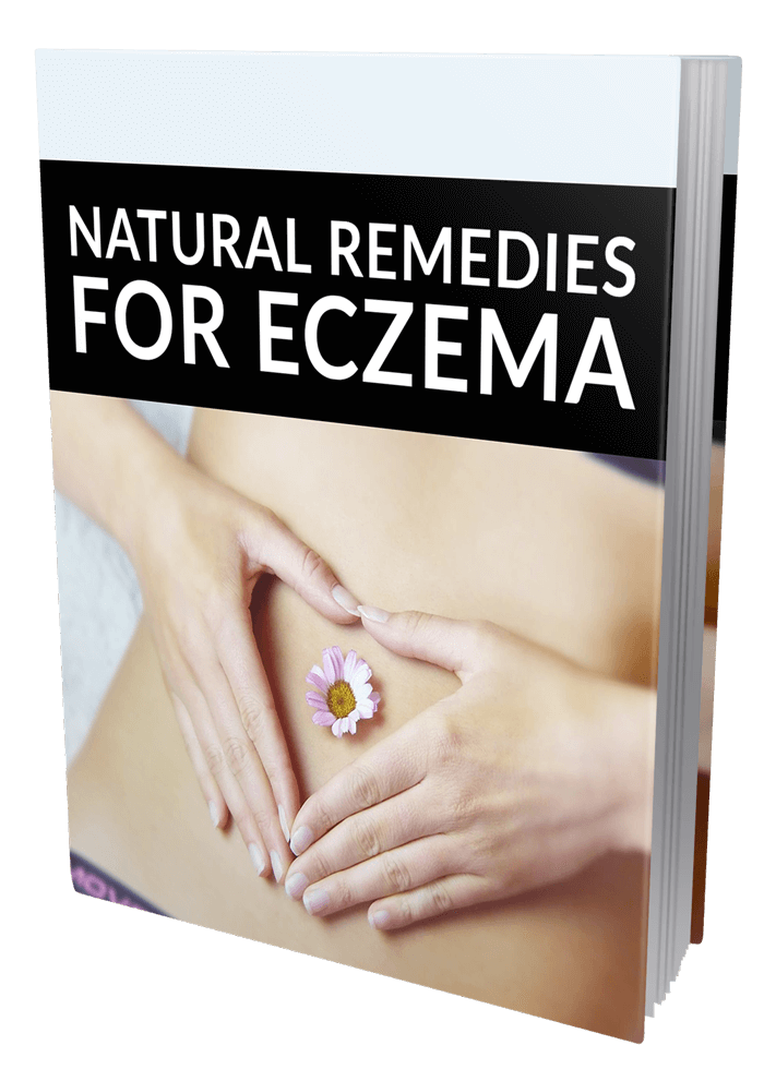 Natural Remedies for Eczema