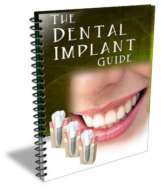 The Dental Implant Guide